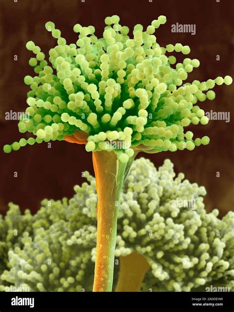 Coloured Scanning Electron Micrograph Sem Of Mould Aspergillus