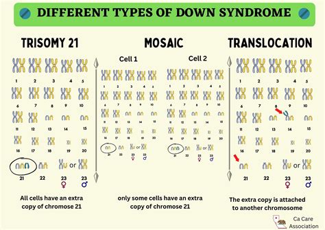 Mosaic Down Syndrome Exploration Healthedupro
