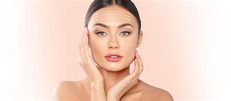 RF-лифтинг на аппарате VIVACE: в чем уникальность процедуры | Сеть ...