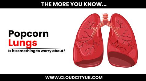 The Truth About Popcorn Lungs | Cloud City UK – Cloud Vapez UK