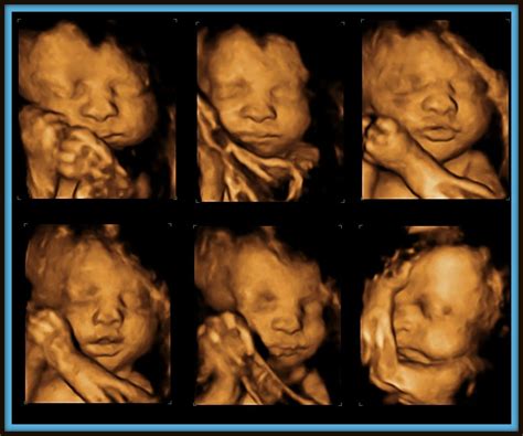 30 Week 4d Ultrasound Retypiano