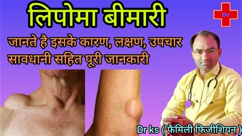 Lipoma Ka Ilaj L Lipoma Kese Hota Hai L Lipoma Kyo Hota Hai L YouTube