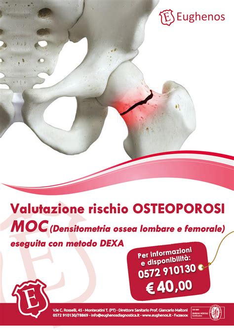 Ottobre 2022 Prevenzione Osteoporosi Eughenos Centro Medico E