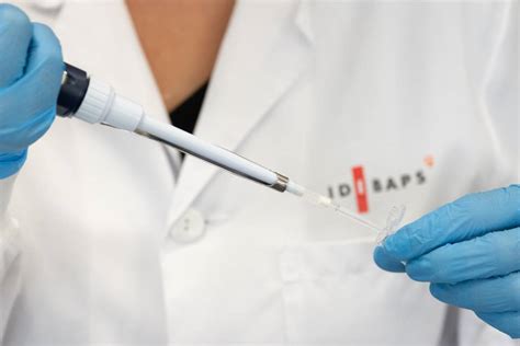 deciphering brain connections  amyotrophic lateral sclerosis