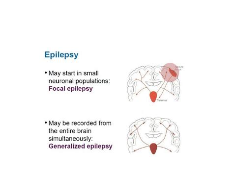 Semiology Of Seizures