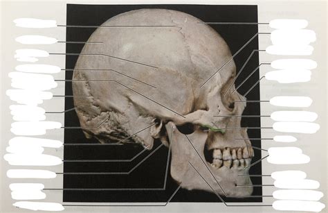 skull bone markings side view Diagram | Quizlet