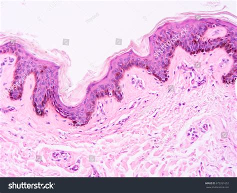 Histology Human Skin Tissue Show Epithelium Stock Photo 675261652