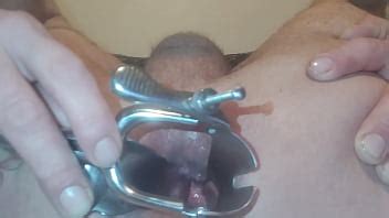 Dilatation Du Cul Lifeisanal XVIDEOS