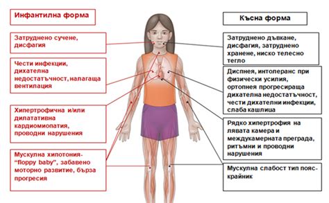 Болест на Помпе | Българско дружество по НМЗ