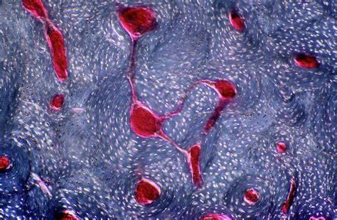 compact bone photograph  microscapescience photo library