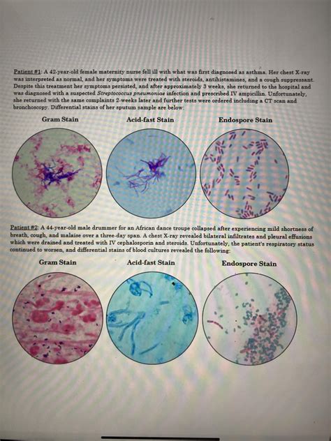 Urine Test Results Meaning Rmicrobiology