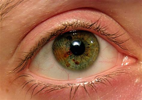 sectoral heterochromia! | Beautiful eyes color, Green eyes, Eye art
