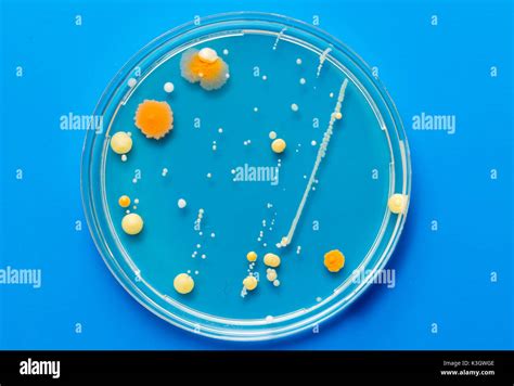 A Petri Dish With Growing Cultures Of Microorganisms Fungi And