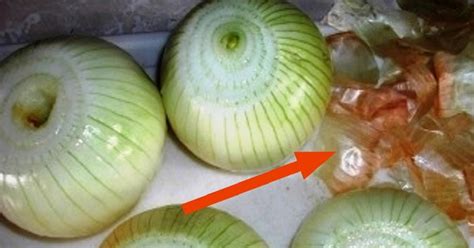 Польза луковой шелухи