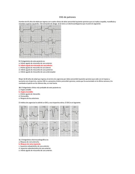 EKG De Patrones Resumen Fisiologia EKG De Patrones Hombre De 65