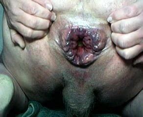 Anal Gaping With Fruit And Veg Part Gay Porn XHamster