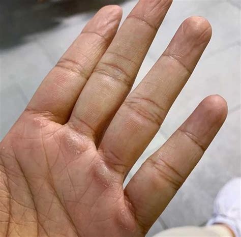 N I Kh Teo V Ng Chai Tay Khi T P C A Hot Gymer B Nh Thu N