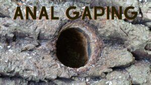 Anal Gape How To Guide Bedbible
