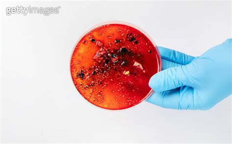 Hand In Blue Glove Holding Petri Dish With Bacterium Microbiology