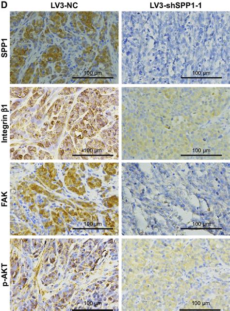 SPP Regulated Tumorigenesis In Nude Mice Model Notes A C Mean