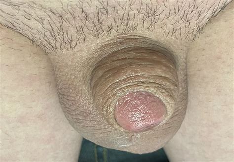 Cute Tiny Micro Cock 13 Nude Pics XHamster