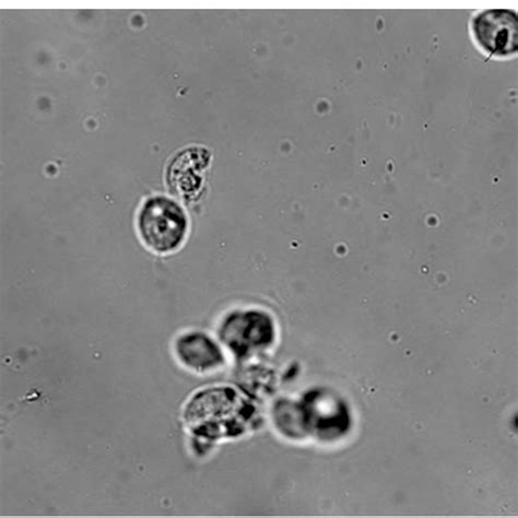 Culture Showing Trichomonas Vaginalis Trophozoites With Nucleus Download Scientific Diagram