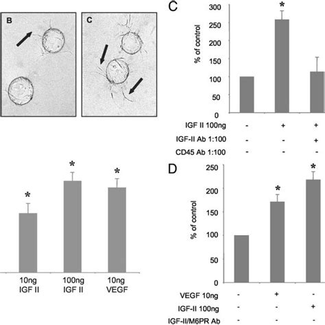 Induction Of Capillary Sprout Formation By IGF II A Photomicrographs