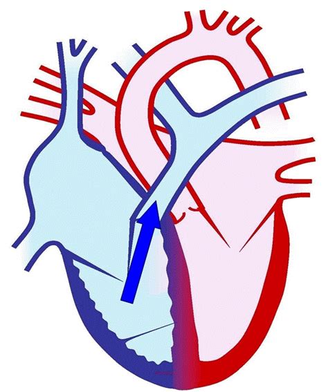 Big Heart Pictures - Beautiful Images of Hearts for Inspiration
