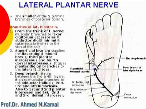 Plantar Nerve Block