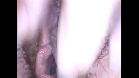 Exploring A Beautiful Hairy Pussy With Medical Endoscope Have Fun Xxx Mobile Porno Videos