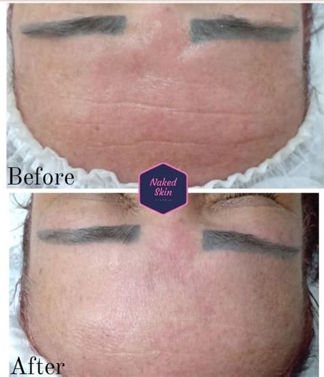 Gallery Naked Skin Facials Wax