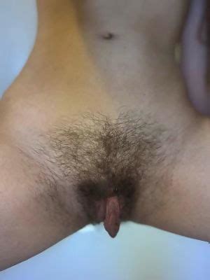 Huge Labia And Hairy Pussy Reddit NSFW