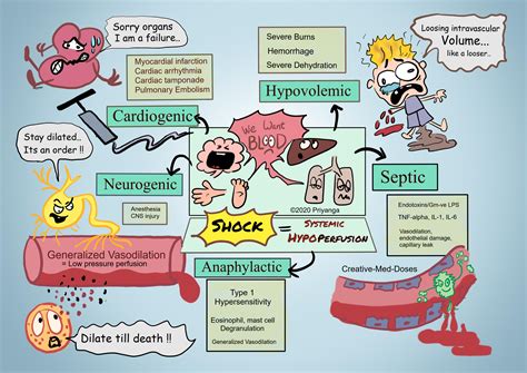 Hypovolemic Shock Nursessity 42 Off
