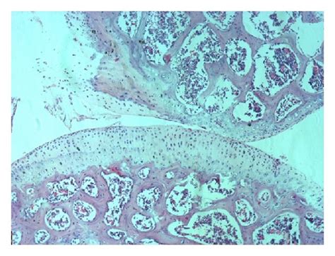 He Staining Of Articular Cartilage Mature Cartilage Layer Was Recorded