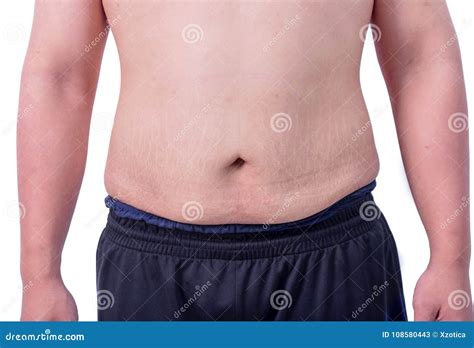 Naked Tummy Of Fat Boy White Background Stock Image Image Of Body Overweight 108580443
