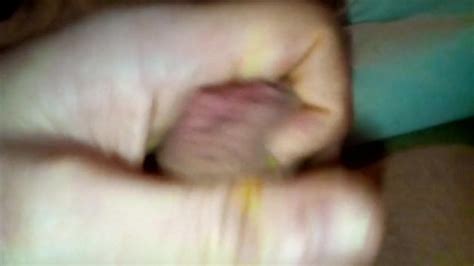 Foreskin Retraction Gay Amateur Amateur Porn XHamster