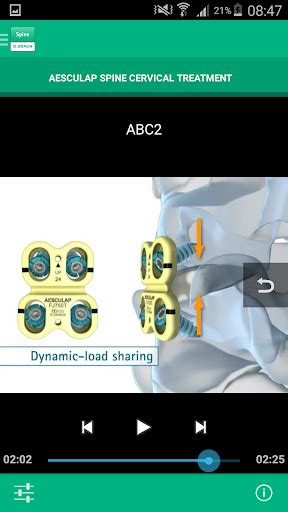 Updated AESCULAP Spine Cervical Mod For Android Windows PC 2023