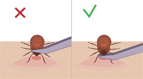 Как защититься от клещей?