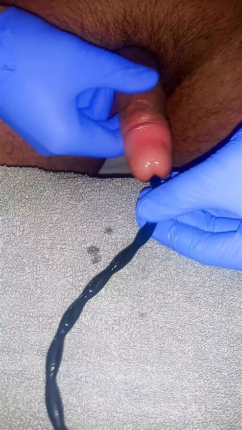 Urethral Sounding And Cum Gay Amateur Amateur Porn Feat Peeholeplayer XHamster
