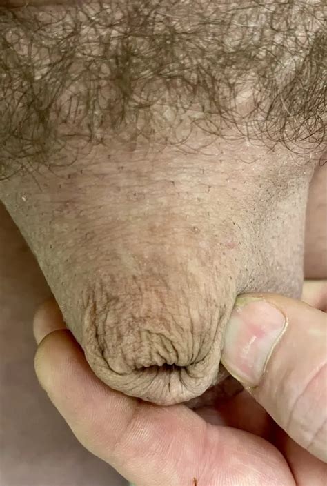 Micro Penis Photos Nude Pics XHamster