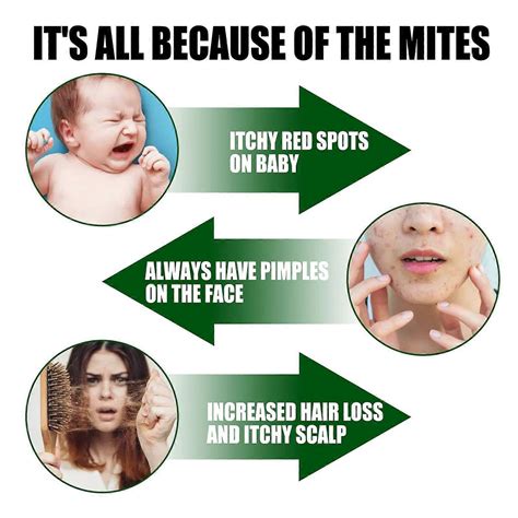 3x Bed Bug And Dust Mite Killer Natural Spray Treatment For Mattresses