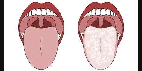 Your Vagina Health 8 Tips To Stay In Tip Top Shape Artofit