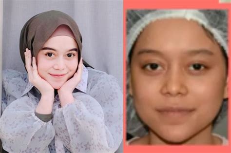 Masih Muda Sudah Permak Wajah, Perubahan Muka Lesti Kejora yang