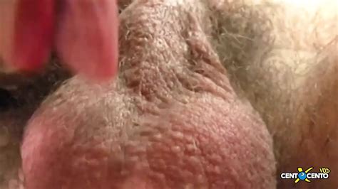 Penetrating Feet And Hands Of Women In Dilated Anus That Becomes A Crater Extreme Full Anal