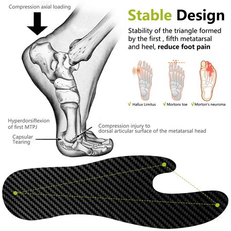 Turf Toe Anatomy Big Toe Joint Pain Sesamoiditis Ohio Podiatric Care