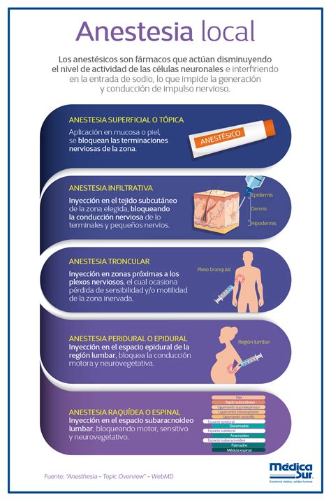 Tipos De Anestesia Diferencia Entre Anestesia Local Y Serwer2311392