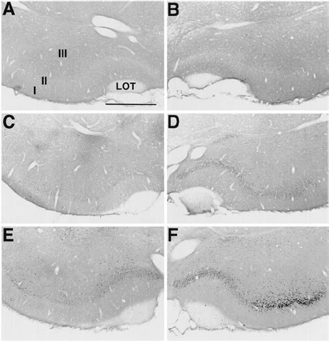 Fos Staining In The Piriform Cortex Sections Were Stained For Fos Download Scientific Diagram