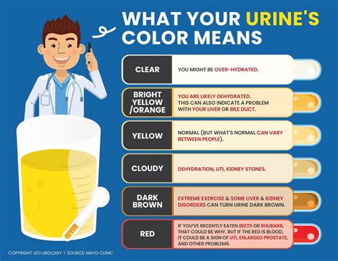 Urology Infographic: What Your Urine's Color Means in 2025 | Color of