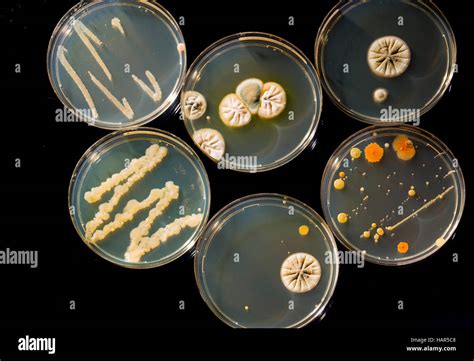 Petri Dish With Colonies Of Bacteria In Hand Hoodoo Wallpaper