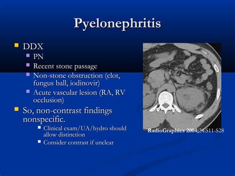 Renal Inflammatory Disease Ppt Free Download